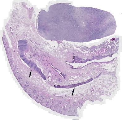 Sagittal histology section of the columella, Hematoxylin and Eosin (HE ...