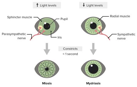 Miosis Is Of The Pupil