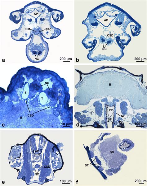 Light micrographs of the semithin sections of the rostrum and head. a ...