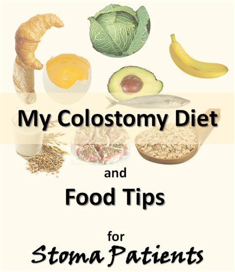 My Food and Diet Tips for Colostomy Patients - Patient's Lounge ...