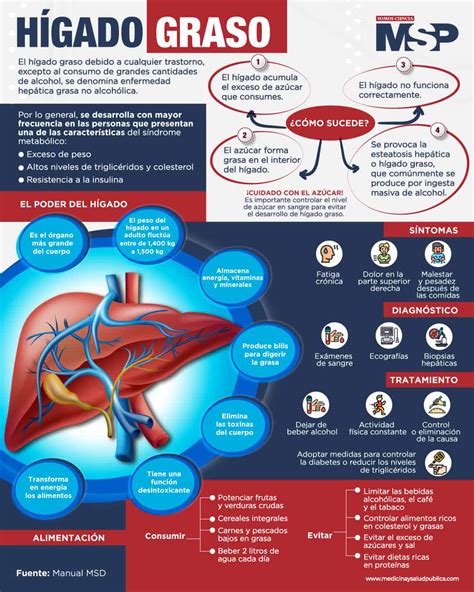 Hígado graso - Infografía