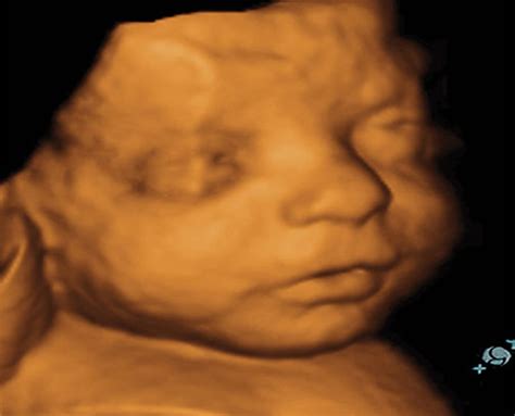 Colorado Prenatal 3D 4D Ultrasound Imaging | Durango Ultrasound