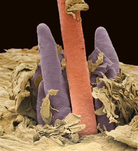 Eyelash Mite Tails, Sem Photograph by Steve Gschmeissner