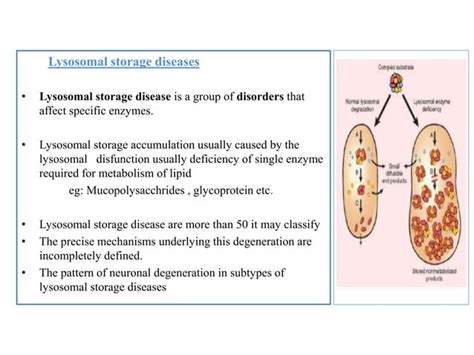 Mucopolysaccharidosis