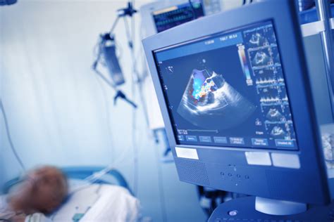 Heart Ultrasound Scans - What to Expect - Heart Health