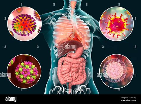 Viral respiratory and enteric infections, illustration Stock Photo - Alamy