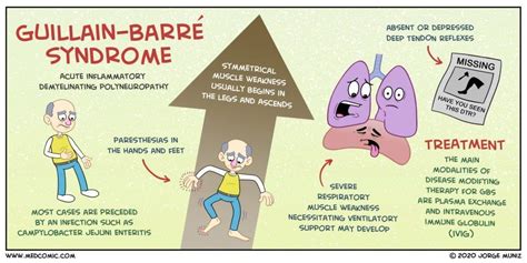 Guillain-Barre syndrome - Rose MacDonald