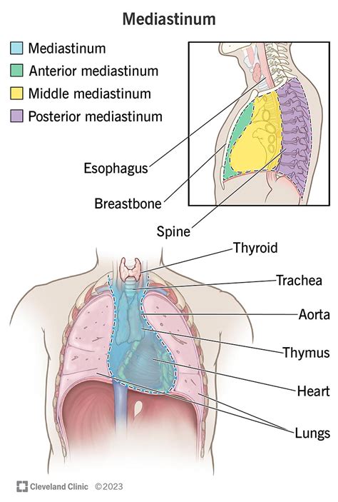 Mediastinal Tumors: Causes, Symptoms, Diagnosis & Treatments