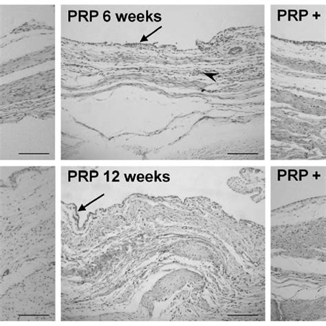 Representative view of synovial membrane histology from experimental ...