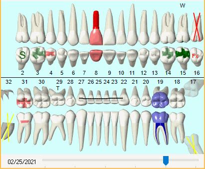 Dentrix Tooth Chart Printable