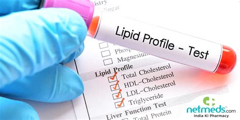 Lipid Profile Test: Why It Is Done And What To Expect