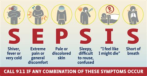 Sepsis | General Medicine | El Camino Health