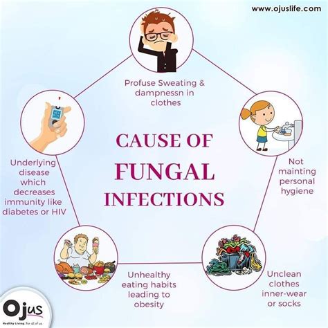 New Fungal Infection 2024 Symptoms - Maura Sherrie