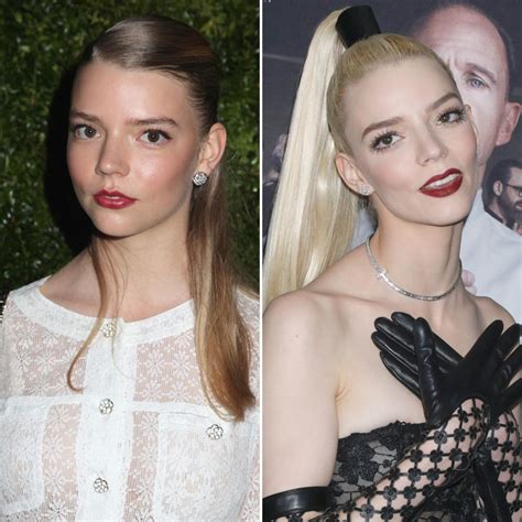 Did Anya Taylor-Joy Get Plastic Surgery? See Photos of the Actress ...