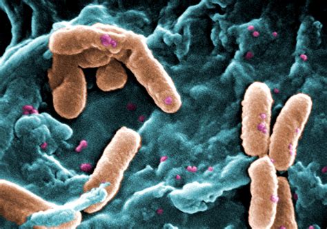 Free photograph; scanning, electron, micrograph, number, pseudomonas ...