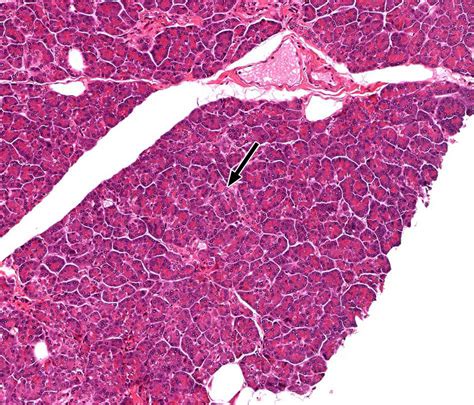 Pancreas | histology