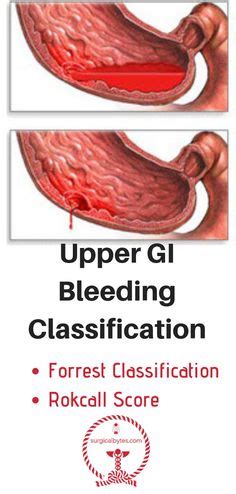 Upper GI bleeding