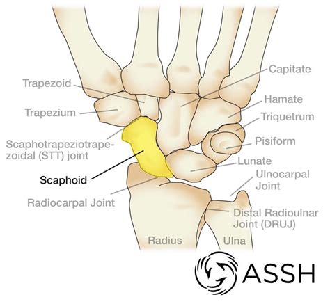 Wrist Anatomy | Kirkland, WA | EvergreenHealth