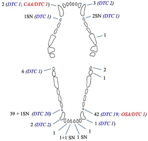 | Histologic representation of a typical dentigerous cyst from one of ...