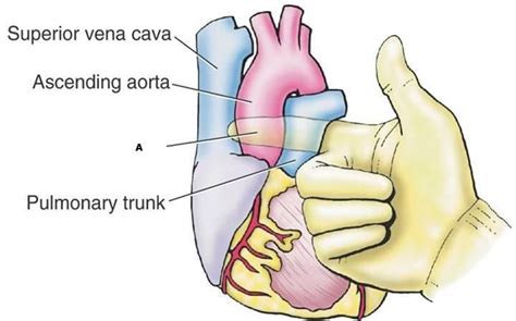 Transverse Pericardial Sinus