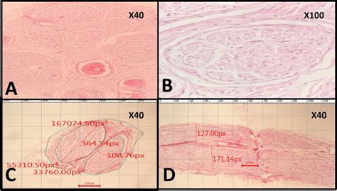 Histopathological sections of the nerves and the method of dimensions ...