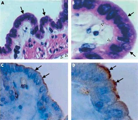 Haematoxylin - eosin staining (A, B) and immunohistochemical ...