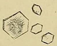 File:Cystine crystals.jpg - Wikimedia Commons