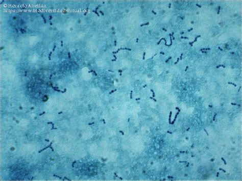 Lactobacillus Acidophilus And Bulgaricus