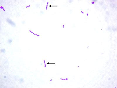 BIOL 230 Lab Manual: Gram Stain of Streptococcus pyogenes