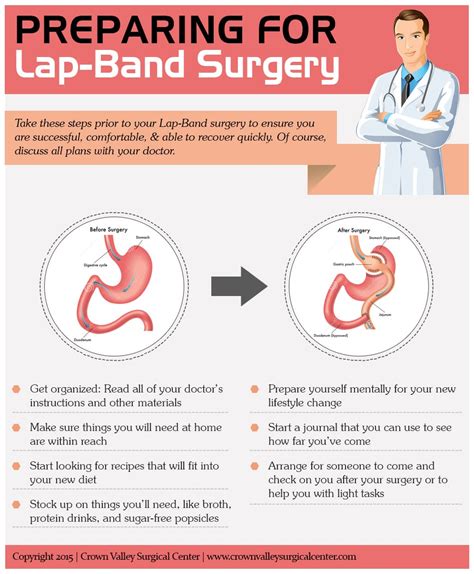 Preparing For Your Lap-Band Surgery | Top O.C Surgery Center | Crown ...