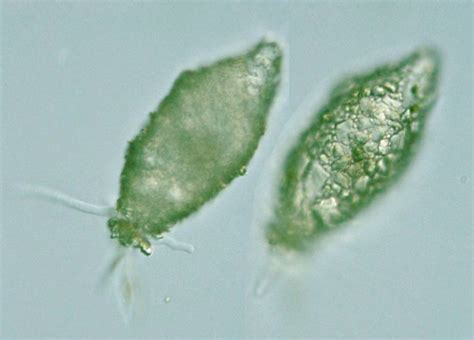 Protist Images: Difflugia