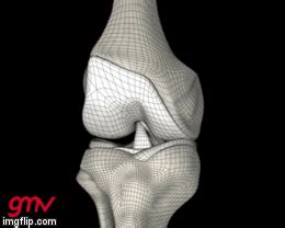 ACL injury mechanism valgus GIF | b-reddy.org