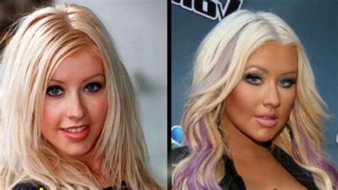 49 Celebrities Before and After Plastic Surgery in 2020 | Celebrities ...