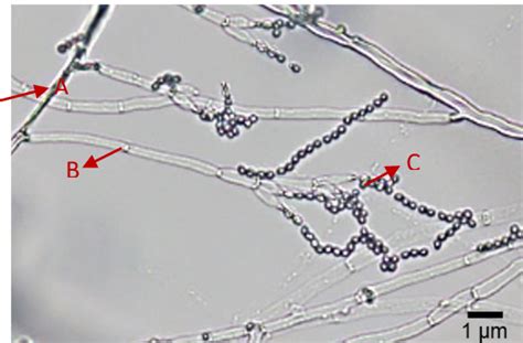 Figure 2 from Morphological and Molecular Identification of Beauveria ...