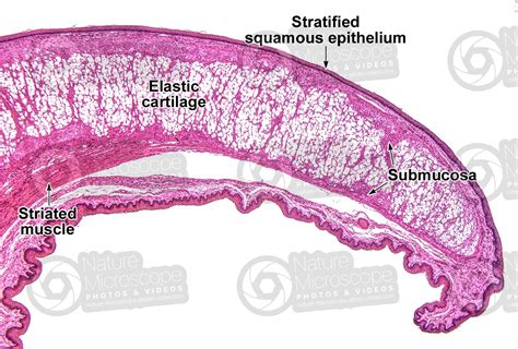 Epiglottis Histology Labeled