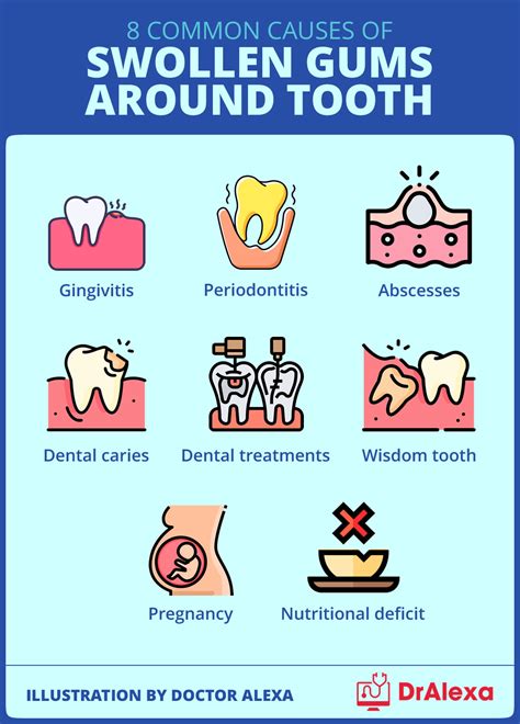 Swollen Gums Around Tooth - Causes and Treatment Options (2023)