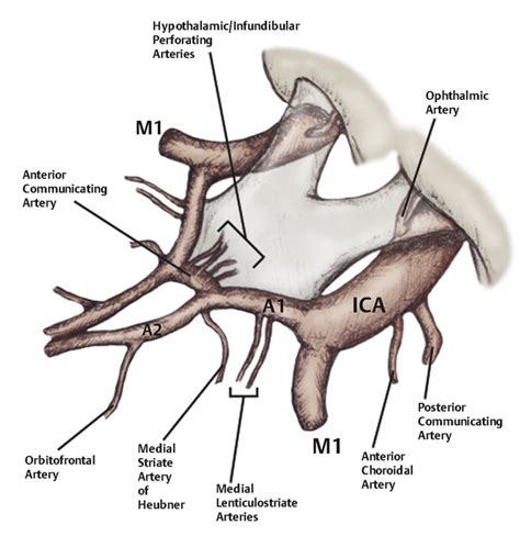 Anterior Communicating Artery Aneurysms | Neupsy Key