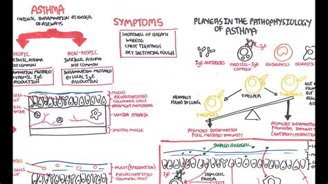 Asthma Pathophysiology - YouTube