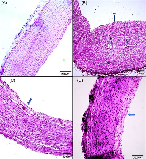 (A) Histology of aorta of intact vehicle control (x200 H&E): Aortal ...