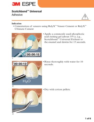 3M RelyX™ Veneer Cement Application Guide - Read Online | Manualzz