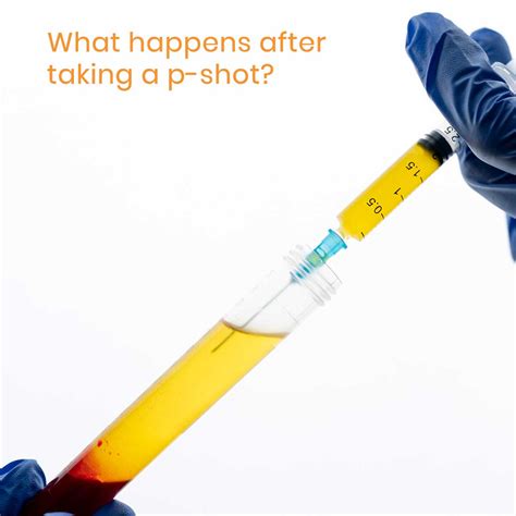 What actually happens during and after the P-shot procedure ...