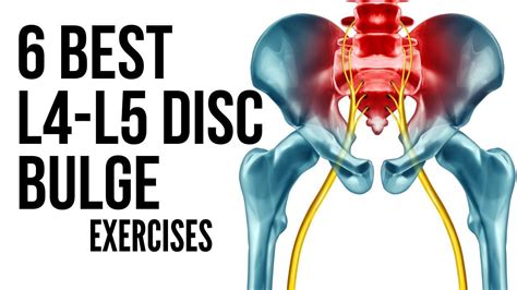 6 Best L4 L5 Disc Bulge Exercises in Hindi to avoid surgery | 6 Best L4 ...