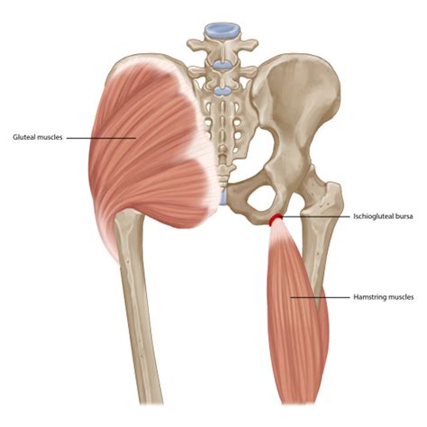 Ischial Bursitis Treatment | Chronic Pain Treatment | Pain Spa, Bristol, UK