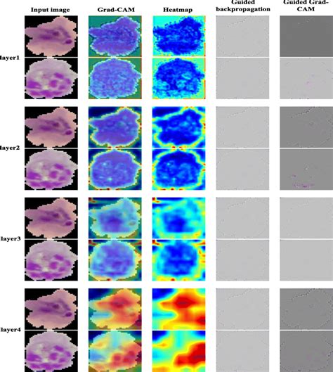 The attention feature map visualization results of different layers ...