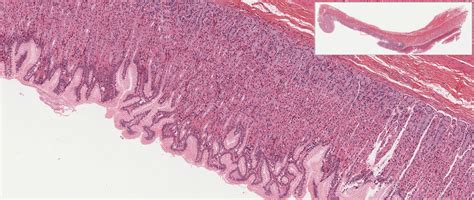 Pharynx, Esophagus, and Stomach | histology