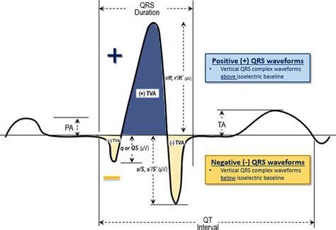 QRS complex waveform measurements. Schematic representation of a ...