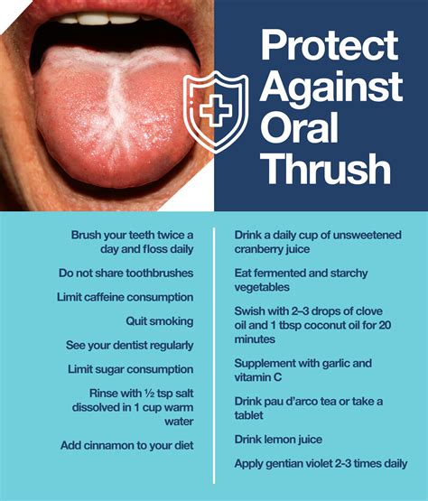 How to Treat Oral Thrush: Beware of These Symptoms! – The Amino Company