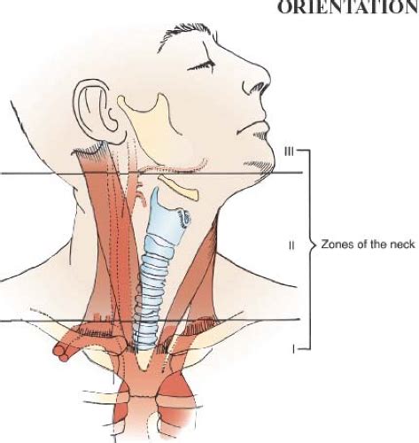 Neck Exploration for Trauma | Basicmedical Key