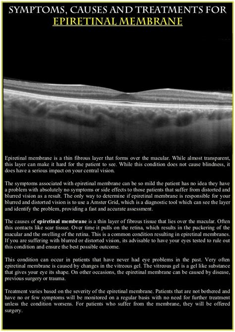 Symptoms,causes and treatments for epiretinal membrane