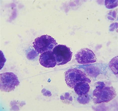 File:Mast cell tumor cytology 2.JPG - Wikimedia Commons | Celulas ...